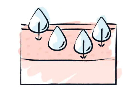 "XS" Hyaluronic Acid (Low Molecular Weight)