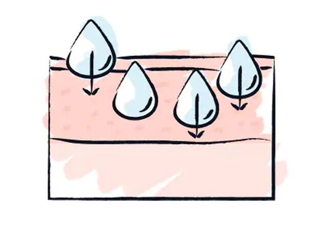"XS" Hyaluronic Acid (Low Molecular Weight)